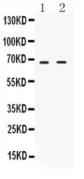 Anti-cIAP2/BIRC3 Antibody Picoband®
