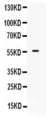 Anti-BMPR1B Antibody Picoband®