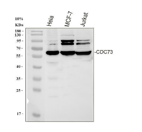Anti-HRPT2/CDC73 Antibody Picoband®