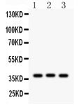 Anti-CTGF Antibody Picoband®
