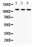 Anti-CYLD Antibody Picoband®
