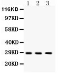 Anti-DKK2 Antibody Picoband®