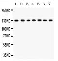 Anti-SAP97/DLG1 Antibody Picoband®