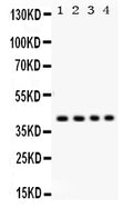 Anti-Parvin alpha/PARVA Antibody Picoband®