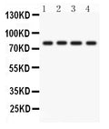 Anti-PKC eta/PRKCH Antibody Picoband®