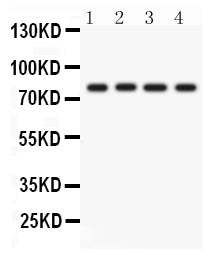 Anti-PKC eta/PRKCH Antibody Picoband®