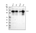 Anti-E Cadherin 1/CDH1 Antibody Picoband®