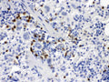 Anti-MCSF/CSF1 Antibody