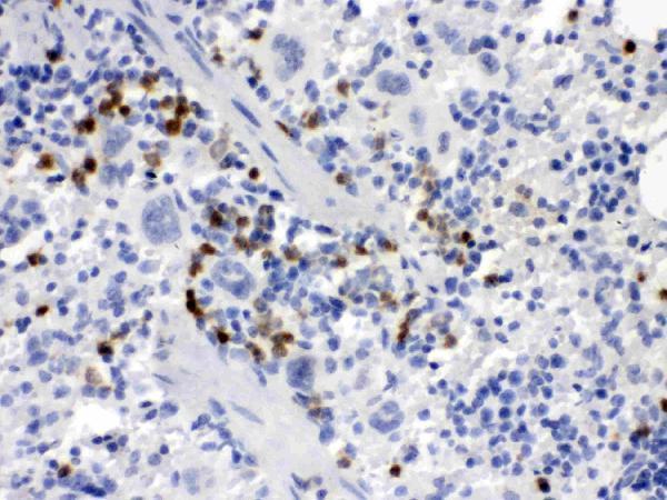Anti-MCSF/CSF1 Antibody