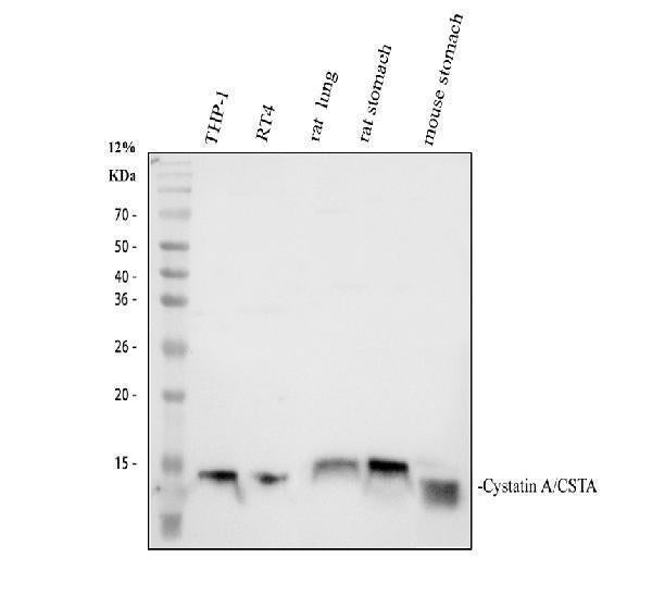 Anti-Cystatin A/CSTA Antibody Picoband®