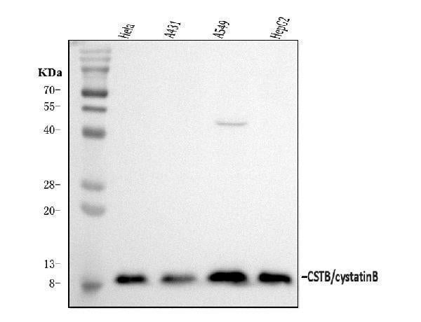 Anti-Stefin B/CSTB Antibody Picoband®