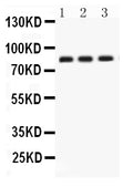 Anti-Apolipoprotein J/CLU Antibody Picoband®