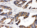 Anti-Lipoamide Dehydrogenase/DLD Antibody Picoband®