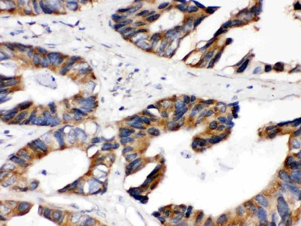 Anti-Lipoamide Dehydrogenase/DLD Antibody Picoband®