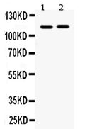 Anti-Eph receptor A5/EPHA5 Antibody Picoband®