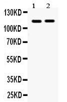 Anti-Eph receptor A5/EPHA5 Antibody Picoband®