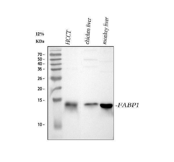 Anti-liver FABP/FABP1 Antibody Picoband®