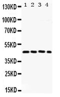 Anti-FRA2/FOSL2 Antibody Picoband®