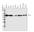 Anti-Fascin/FSCN1 Antibody Picoband®
