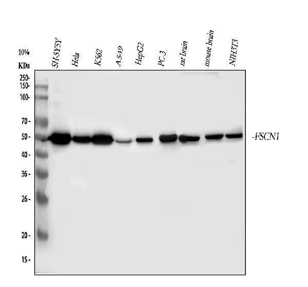 Anti-Fascin/FSCN1 Antibody Picoband®