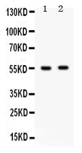 Anti-GABA A Receptor beta 3/GABRB3 Antibody Picoband®