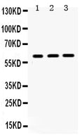 Anti-HNF1 beta/HNF1B Antibody Picoband®