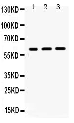 Anti-HNF1 beta/HNF1B Antibody Picoband®