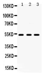 Anti-5HT2A Receptor/HTR2A Antibody Picoband®