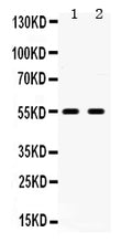 Anti-5HT2B Receptor/HTR2B Antibody Picoband®