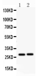 Anti-IGFBP1 Antibody Picoband®