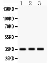 Anti-IGFBP2 Antibody Picoband®