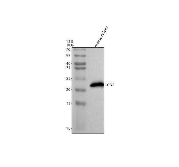 Anti-Lipocalin 2/LCN2 Antibody Picoband®