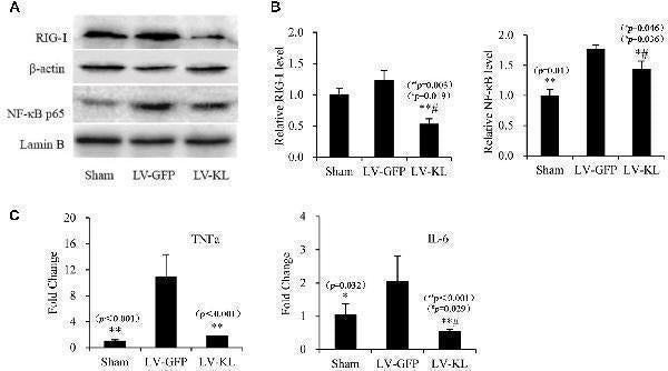 Anti-Lamin B1/LMNB1 Antibody Picoband®