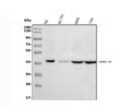 Anti-MICA Antibody Picoband®
