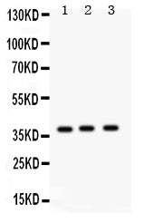 Anti-Surfactant protein D/SFTPD Antibody Picoband®