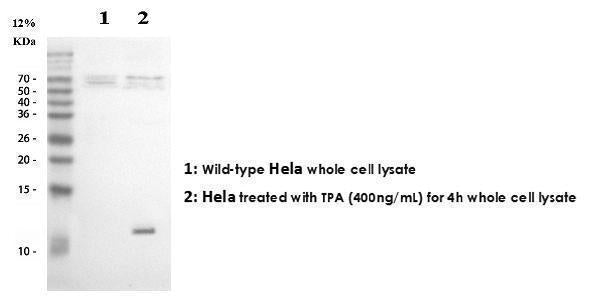 Anti-IL8/CXCL8 Antibody Picoband®