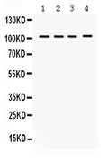 Anti-HDAC7 Antibody Picoband®