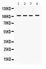 Anti-HDAC7 Antibody Picoband®