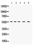 Anti-IRF5 Antibody Picoband®