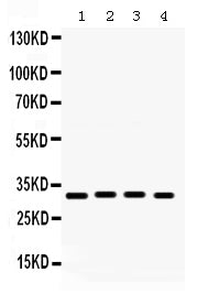 Anti-KChIP2/KCNIP2 Antibody Picoband®