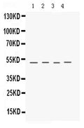 Anti-Keratocan Antibody Picoband®