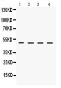 Anti-LCAT Antibody Picoband®