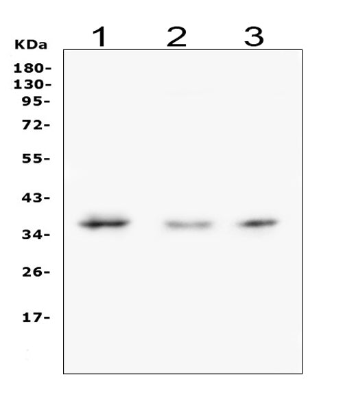 Anti-Galectin 8/LGALS8 Antibody Picoband®