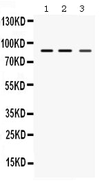 Anti-MEFV Antibody Picoband®