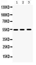 Anti-MMP10 Antibody Picoband®
