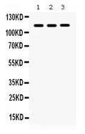 Anti-CARD12/NLRC4 Antibody Picoband®