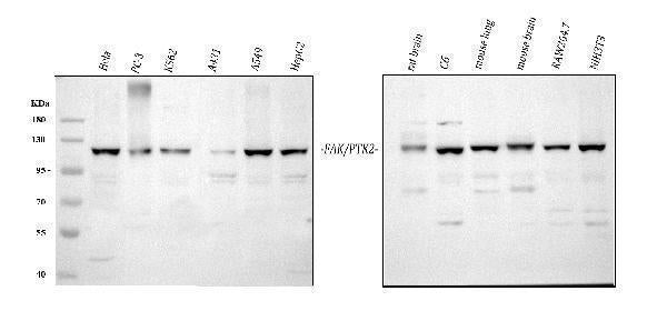 Anti-FAK/PTK2 Antibody Picoband®