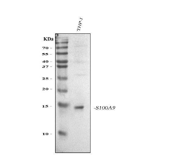 Anti-S100A9 Antibody Picoband®