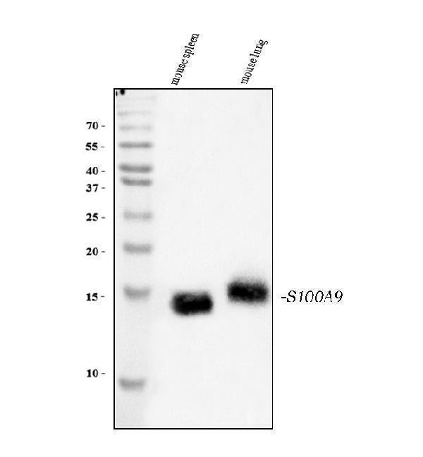 Anti-S100A9 Antibody Picoband®