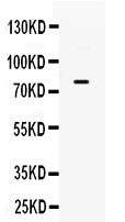 Anti-GRK3/ADRBK2 Antibody Picoband®